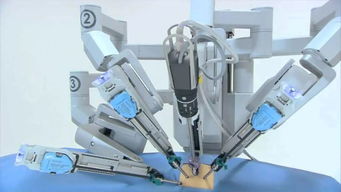 機(jī)器人制霸手術(shù)臺(tái) 外企壟斷格局下，國(guó)產(chǎn)普通機(jī)械制造的突圍之路